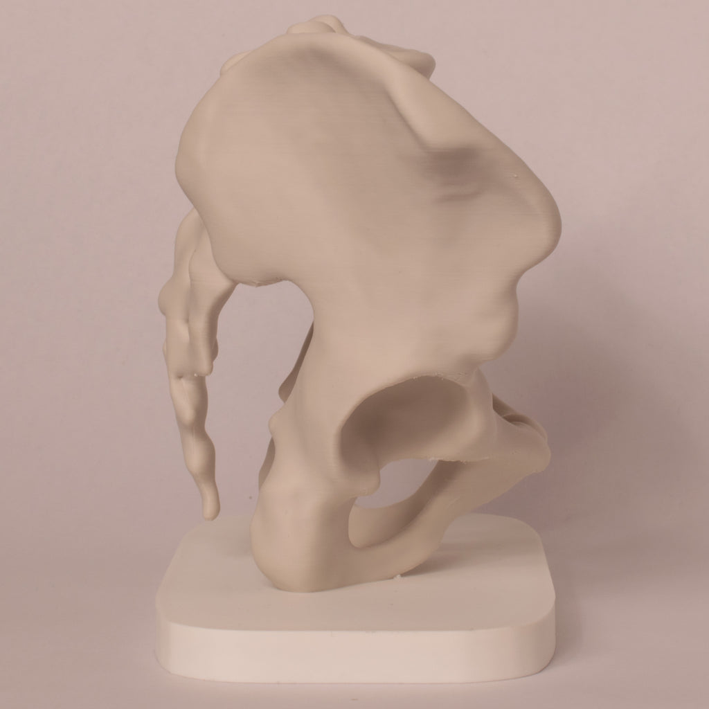 Anatomisk bekken