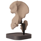 Anatomisk hofte – total hofteprotese
