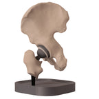 Anatomisk hofte – total hofteprotese