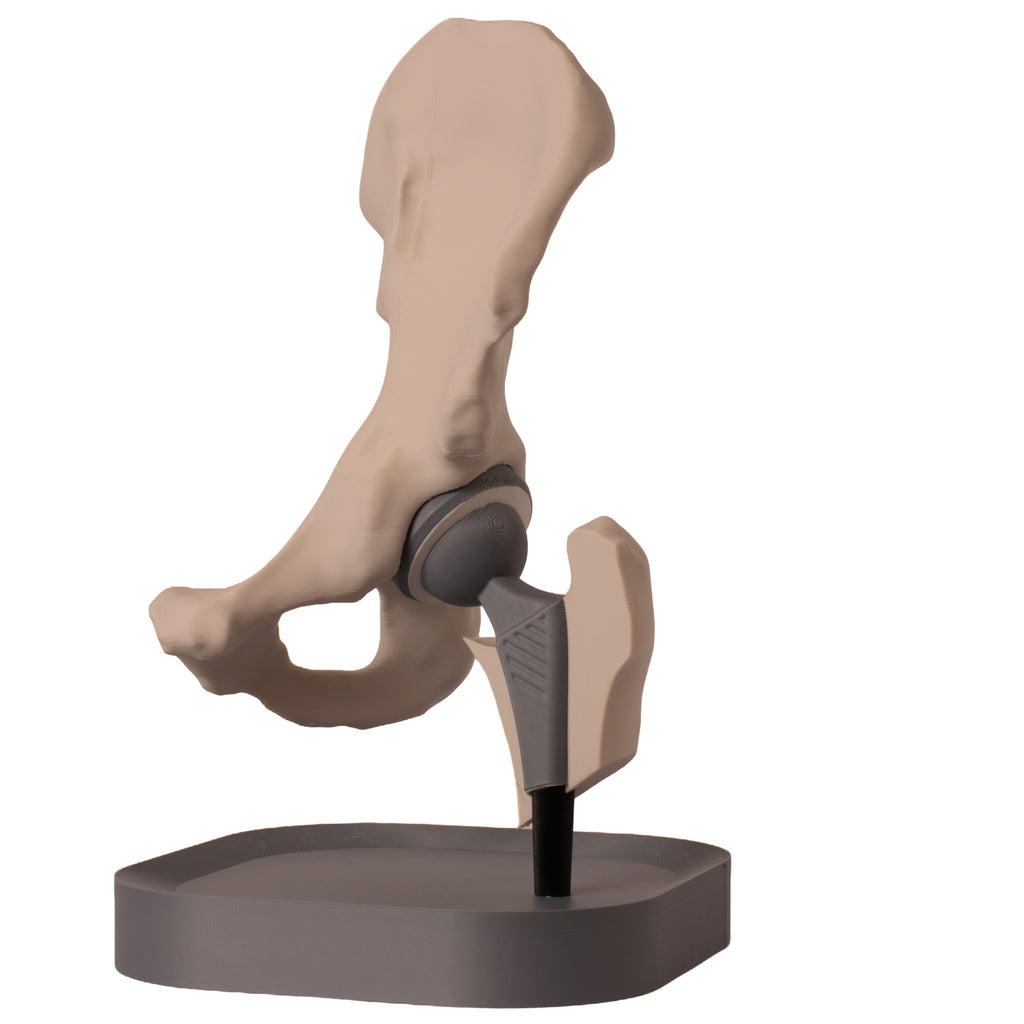 Anatomisk hofte – total hofteprotese