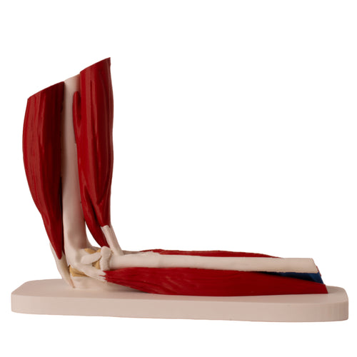 Anatomisk albue