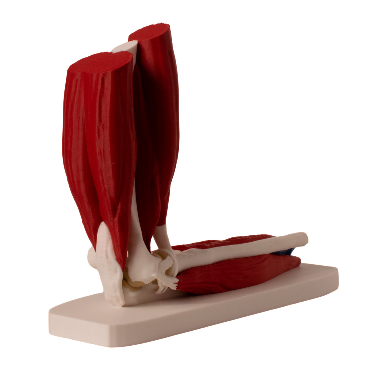 Anatomisk albue
