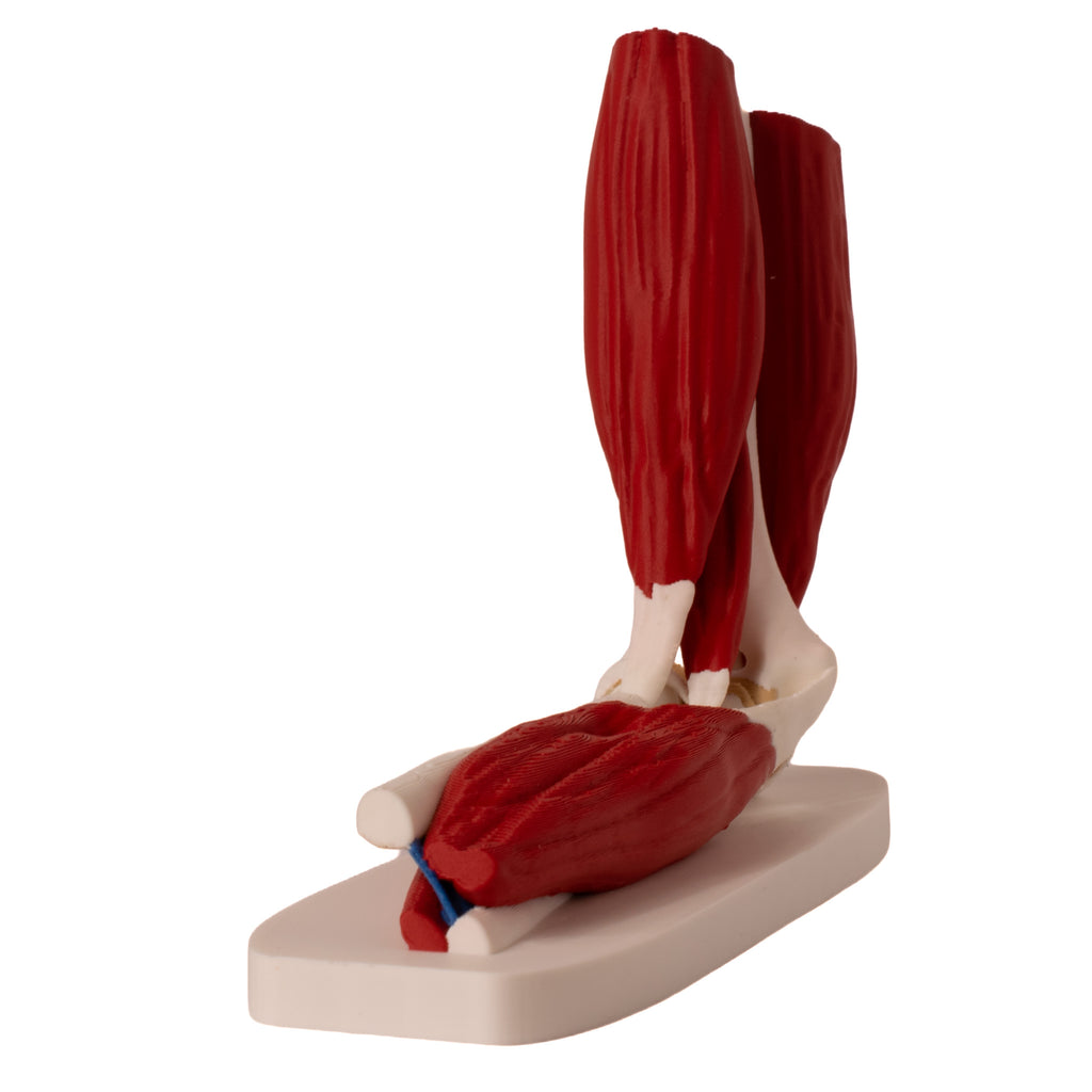 Anatomisk albue