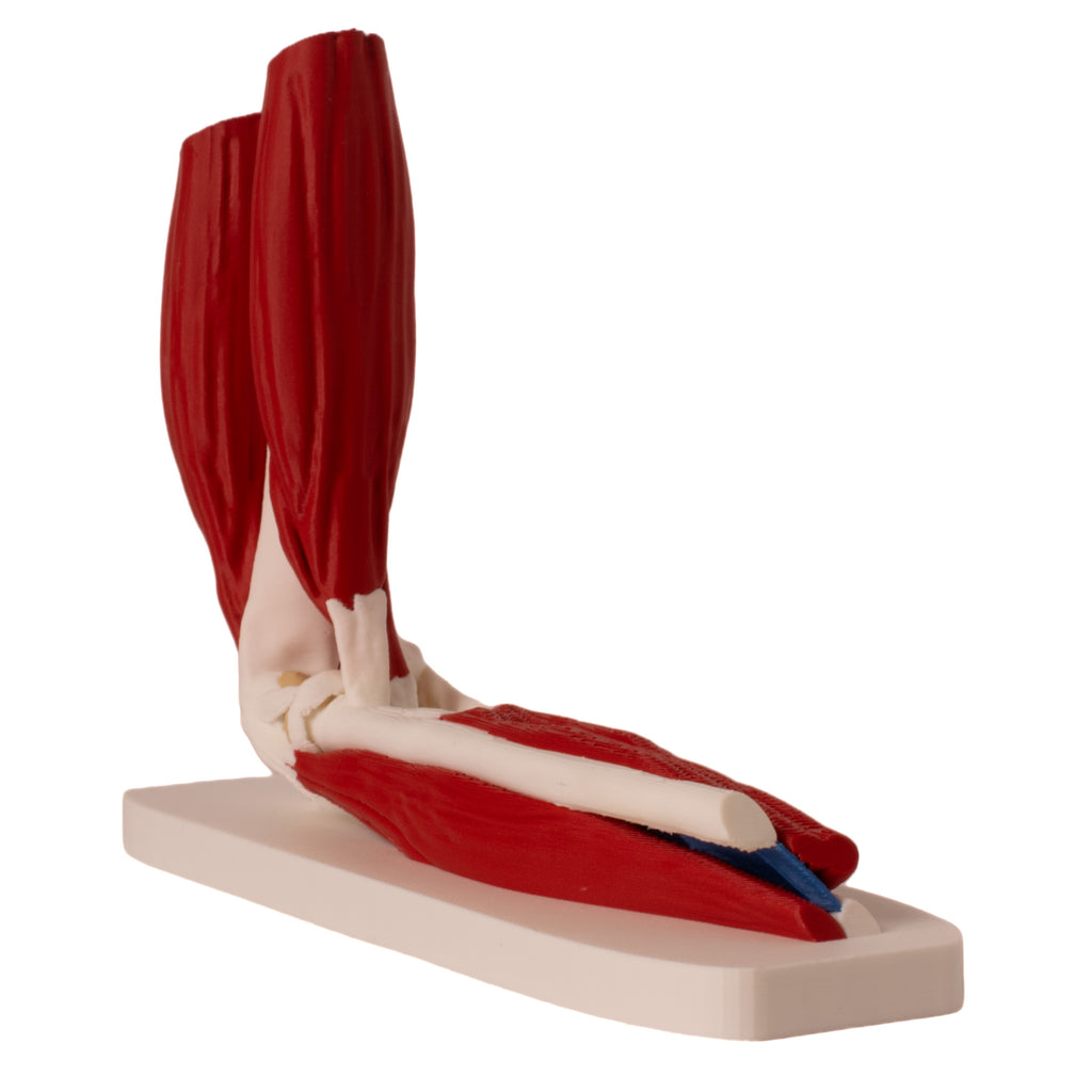 Anatomisk albue