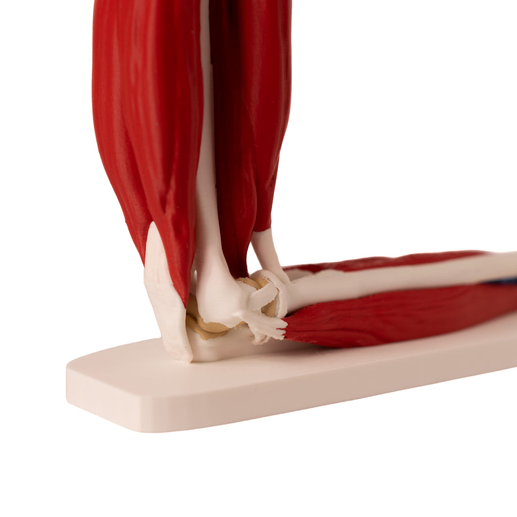 Anatomisk albue