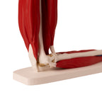 Anatomisk albue