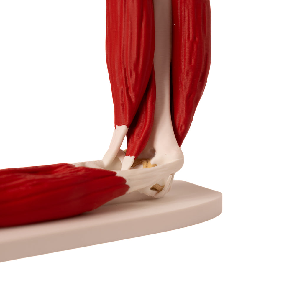 Anatomisk albue